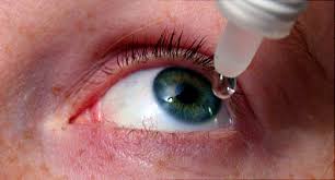 dry eyes being treated with eyedrops